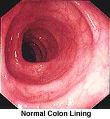 normal colon