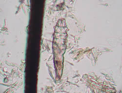 Demodex folliculorum mite next to a human hair